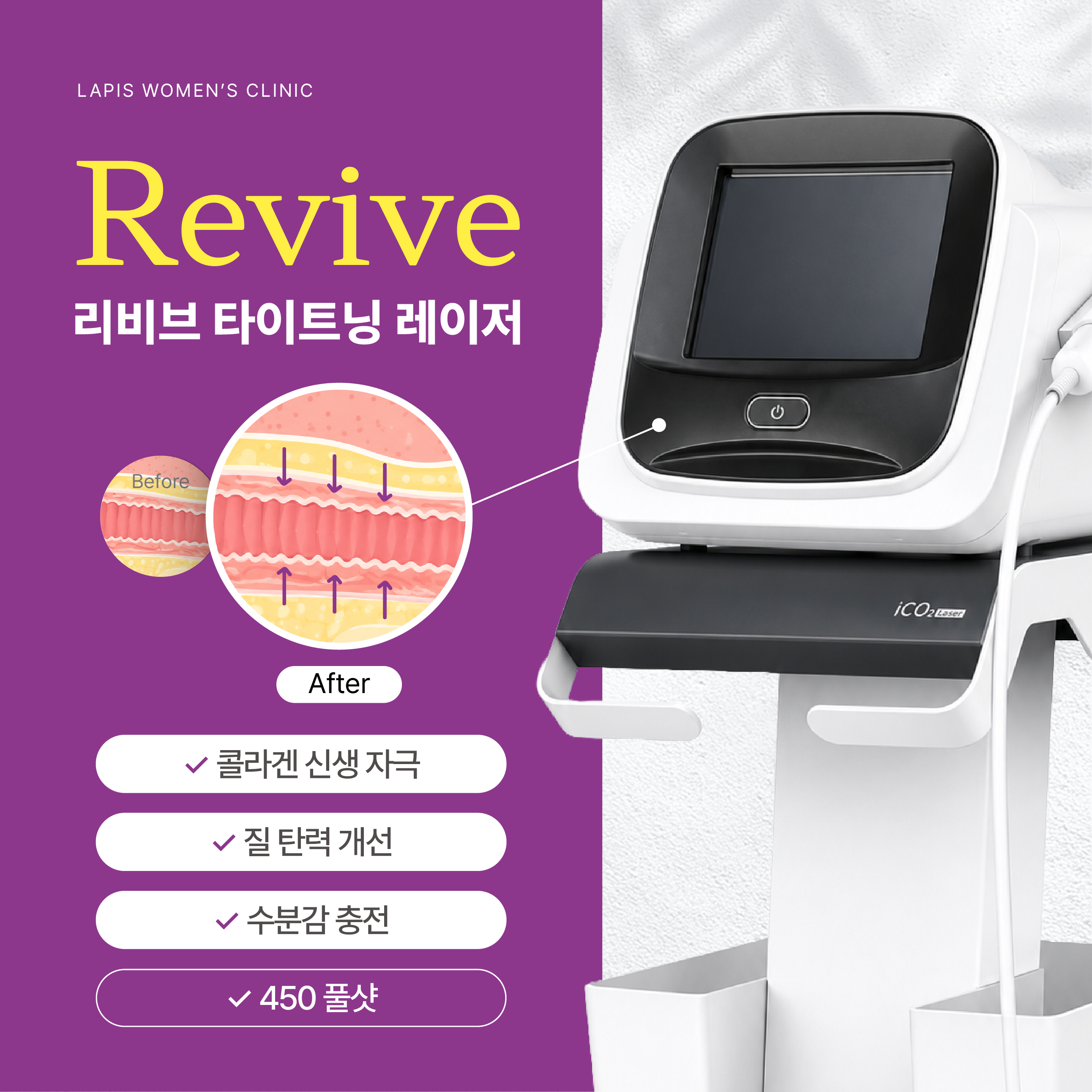 콜라겐 재생 리비브